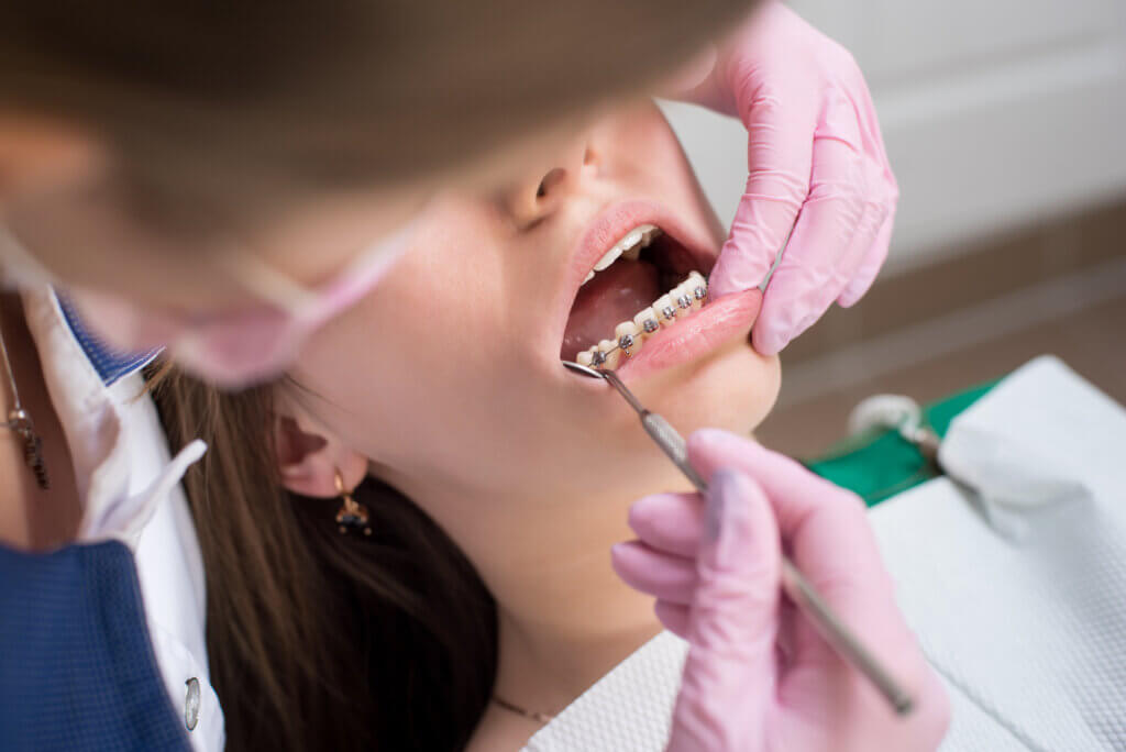 aparat dentar metalic