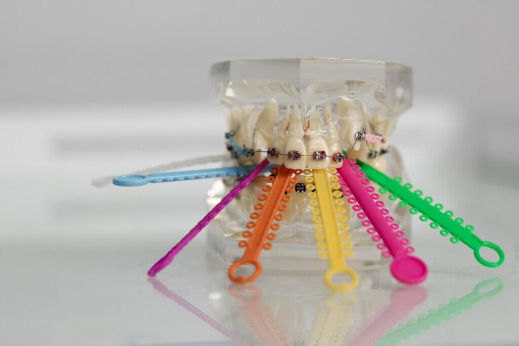 Medicul ortodont explică igiena orală corectă pentru purtătorii de aparat dentar