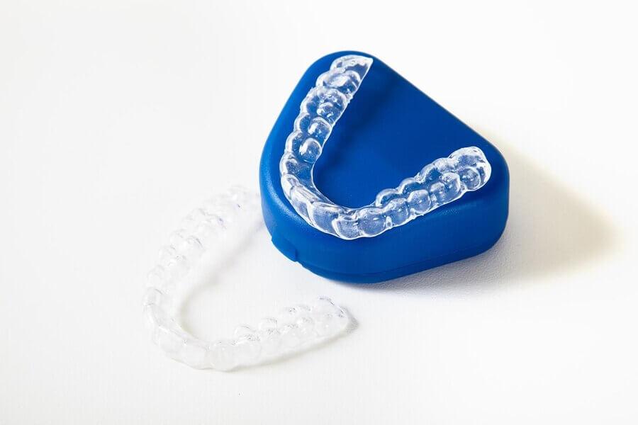 Gutieră de contenție după aparat dentar – menținerea rezultatelor ortodontice