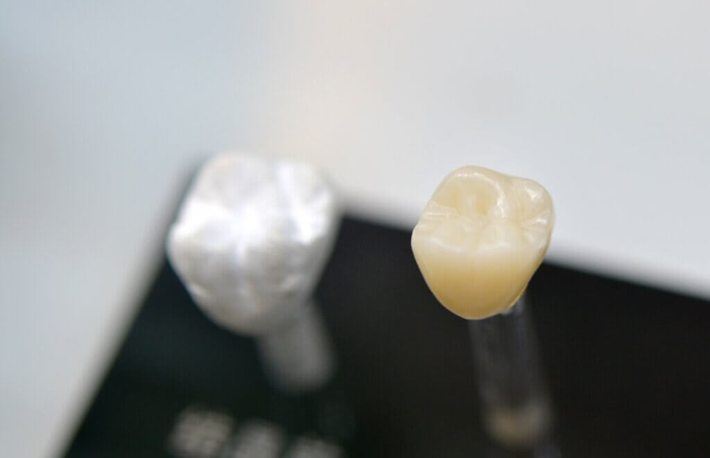 coroane dentare zirconiu fără metal