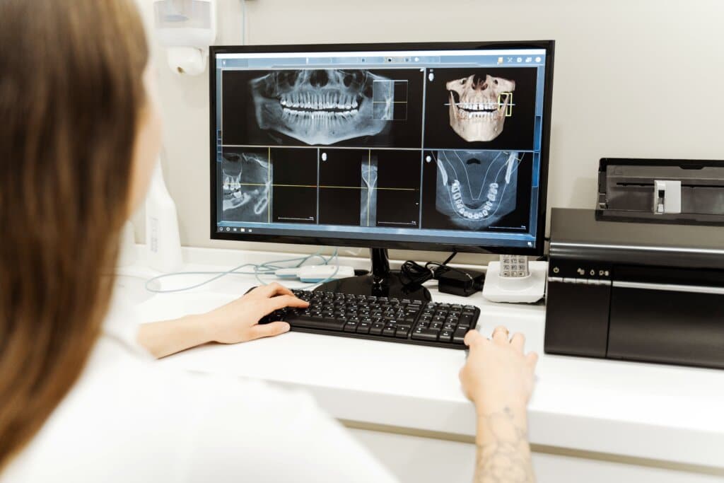 Tomografie dentară înainte de implant: De ce nu ar trebui să sari peste acest pas?