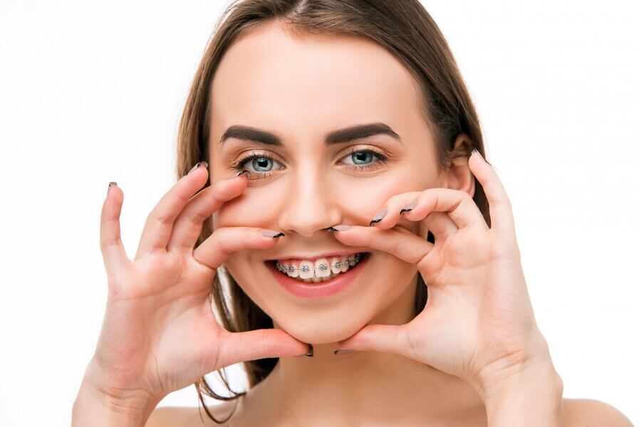Aparat dentar metalic