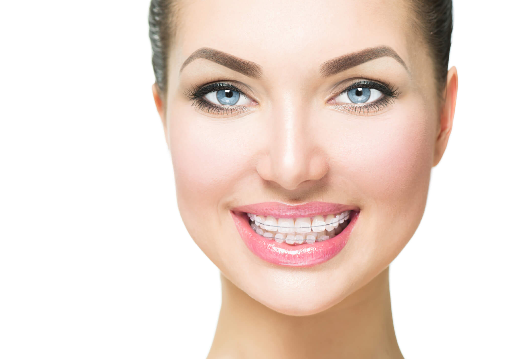Aparat dentar safir