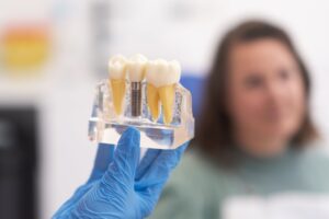 Implant dentar Straumann pentru zâmbet sănătos și natural