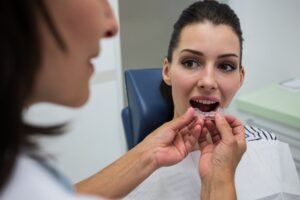 Albirea dentară acasă cu gutiere realizate de medic la INO Dental