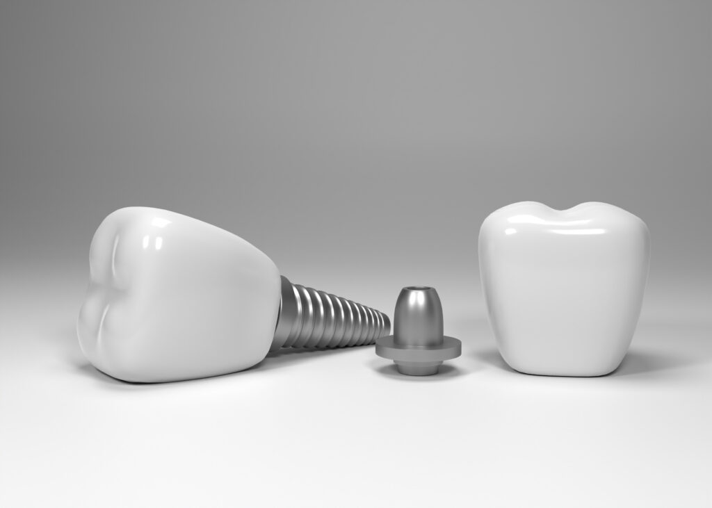 Implant dentar Straumann cu tehnologie SLActive, utilizat la INO Dental București